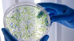 Superbactéria mata bebê em UTI neonatal em Porto Alegre