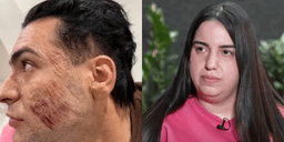Natalia Becker (à dir.) teria feito cortes na pele do rosto de Henrique Chagas (à esq.), que morreu após passar pelo procedimento de peeling de fenol