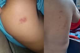 MT: mãe registra BO após filho chegar com hematomas da escola