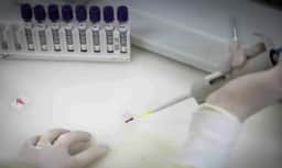 São Paulo investiga novo caso suspeito de Ebola 