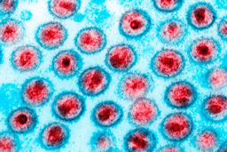 Mais duas pessoas foram curadas do HIV, dizem médicos
