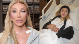 Maya Massafera relata resultado de cirurgia no ombro