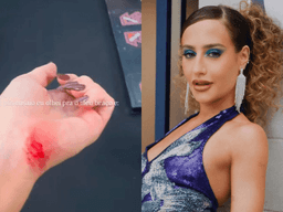 Bruna Griphao se machuca em ensaio na Dança dos Famosos