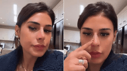 Simone Mendes nega rinoplastia e explica nariz