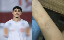 Jogador é preso suspeito de agredir jovem e ameaçar ex-namorada em Goiás