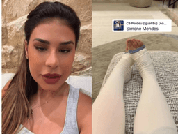 Simone Mendes revela detalhes de cirurgia nas coxas