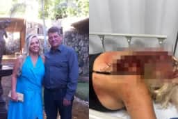 PCMG pede medida protetiva para mulher agredida a golpes de barra de ferro em BH