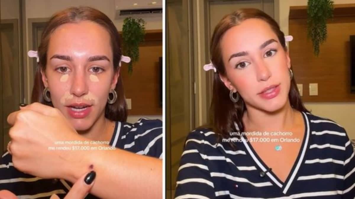 Influenciadora brasileira leva mordida de poodle e recebe conta de R$ 84 mil nos EUA