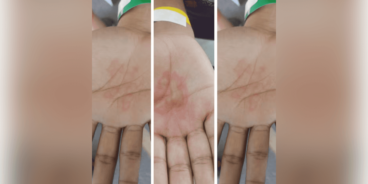 Pai é preso suspeito de queimar mãos dos três filhos com comida fervendo na Grande BH