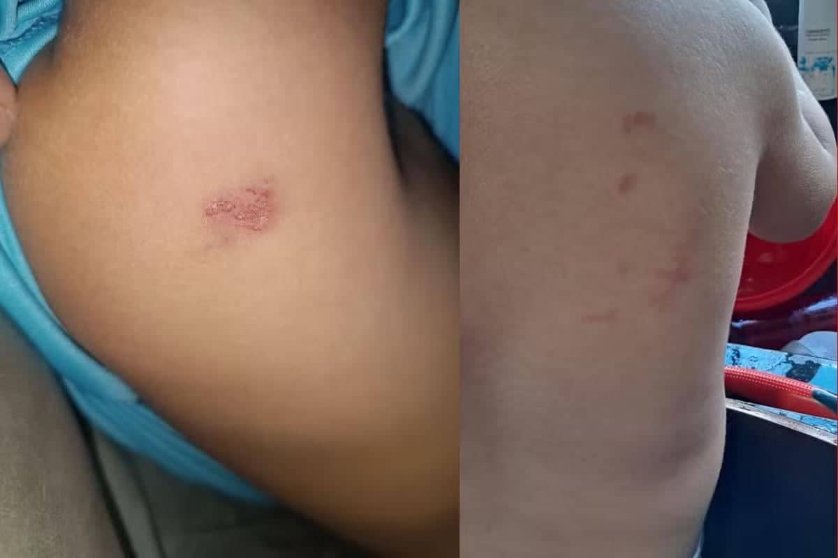 MT: mãe registra BO após filho chegar com hematomas da escola