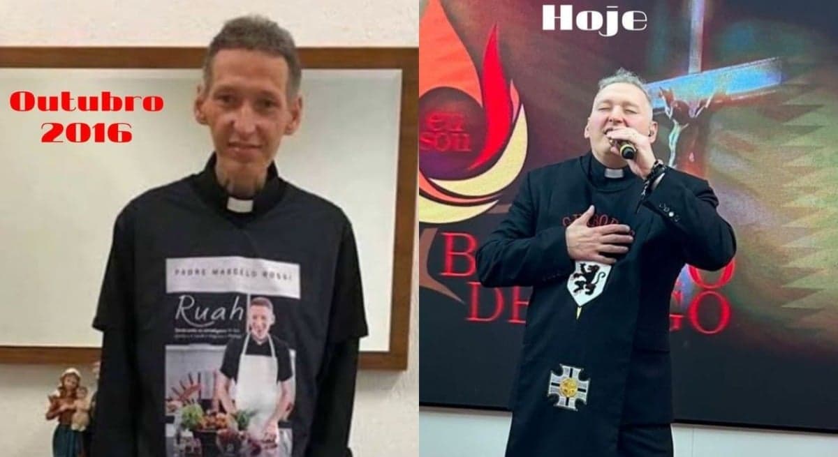 Padre Marcelo Rossi mostra antes e depois de cura da depressão