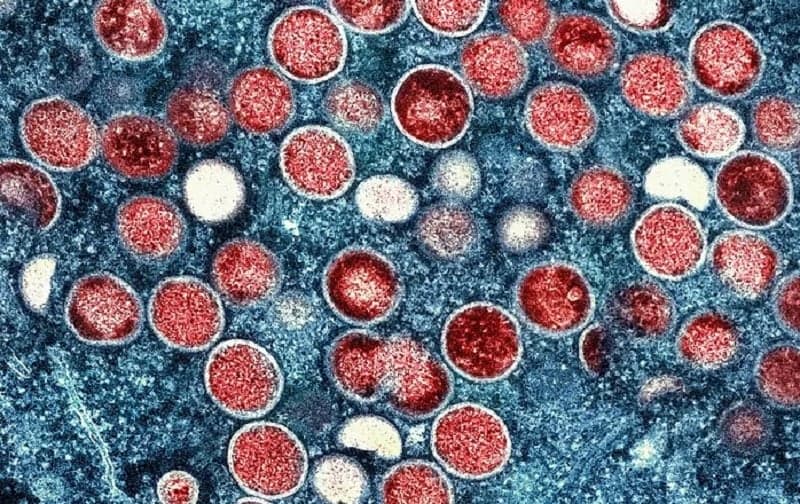 Mpox | Foto: Wikimedia Commons