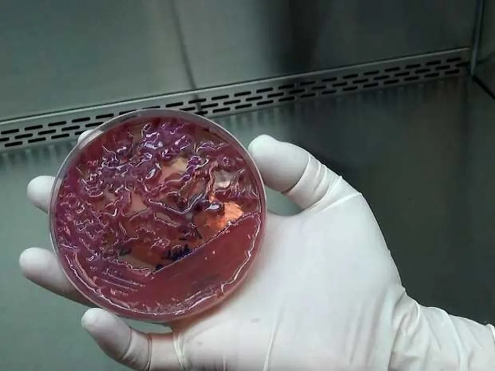 Superbactéria leva ao fechamento de UTI em hospital de Campinas