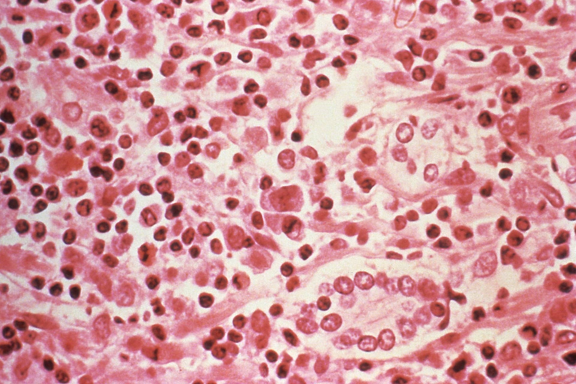 Hantavírus - Foto: CDC