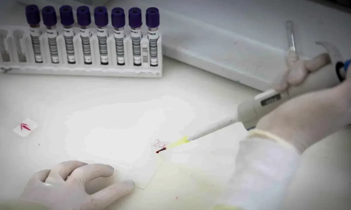 Exame de RT-PCR é o teste molecular padrão-ouro para o diagnóstico do Ebola © Pablo Jacob/Governo de SP